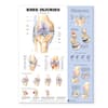 Knee Injuries Anatomical Chart