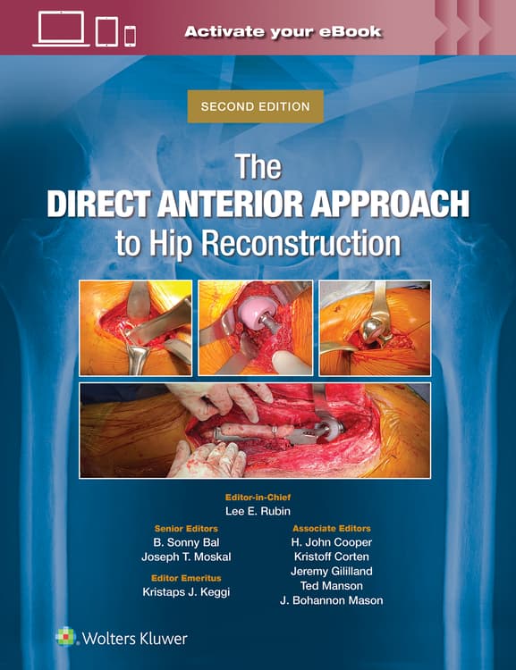 The Direct Anterior Approach to Hip Reconstruction