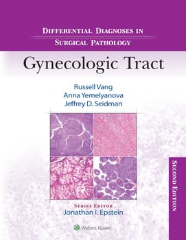 Differential Diagnoses in Surgical Pathology: Gynecologic Tract