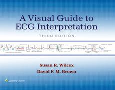 A Visual Guide to ECG Interpretation: eBook with Multimedia
