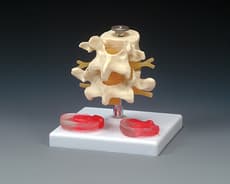 Budget Lumbar Vertebrae With Interchangeable Discs