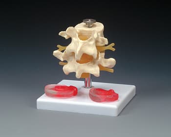 Budget Lumbar Vertebrae With Interchangeable Discs