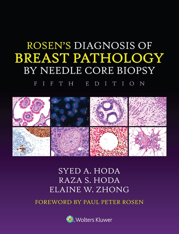 Rosen's Diagnosis of Breast Pathology by Needle Core Biopsy