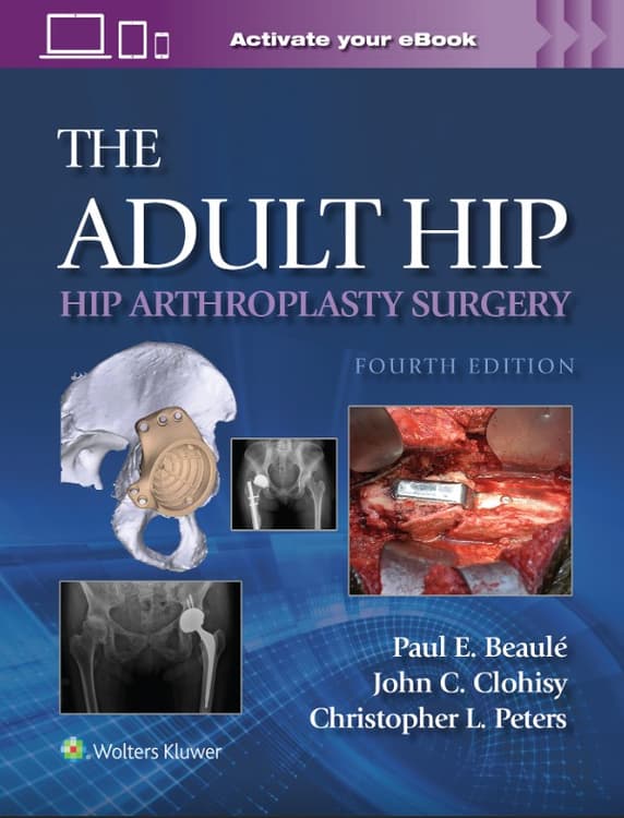 The Adult Hip: Hip Arthroplasty Surgery Print + eBook with Multimedia