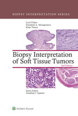 Biopsy Interpretation of Soft Tissue Tumors