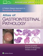 Atlas of Gastrointestinal Pathology: A Pattern Based Approach to Neoplastic Biopsies