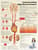 Understanding High Blood Pressure