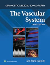 Diagnostic Medical Sonography: The Vascular System 3e Lippincott Connect Print Book and Digital Access Card Package
