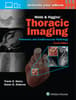 Webb & Higgins Thoracic Imaging: Print + eBook with Multimedia