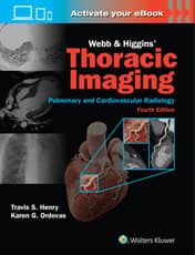 Webb & Higgins Thoracic Imaging: Print + eBook with Multimedia