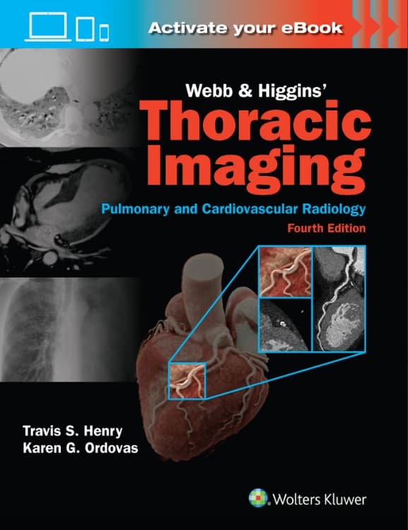 Webb & Higgins Thoracic Imaging: Print + eBook with Multimedia