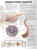 Understanding Diabetes Anatomical Chart