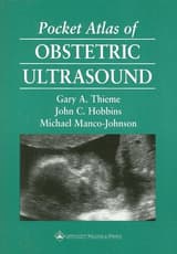 Pocket Atlas of Obstetric Ultrasound
