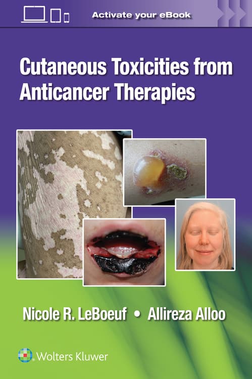 Cutaneous Reactions from Anti-Cancer Therapies