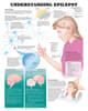 Understanding Epilepsy Anatomical Chart