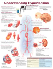 Understanding Hypertension Anatomical Chart