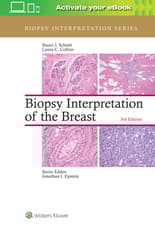 Biopsy Interpretation of the Breast