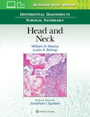 Differential Diagnoses in Surgical Pathology: Head and Neck