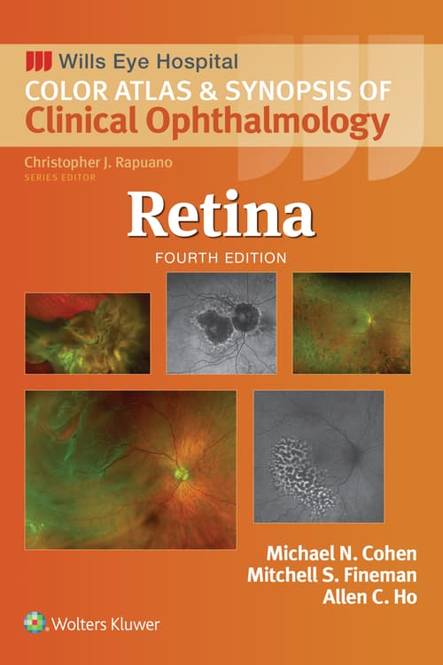 Retina