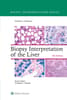 Biopsy Interpretation of the Liver