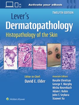 Lever's Dermatopathology: Histopathology of the Skin