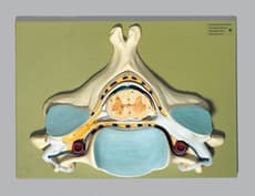 Fifth Cervical Vertebra