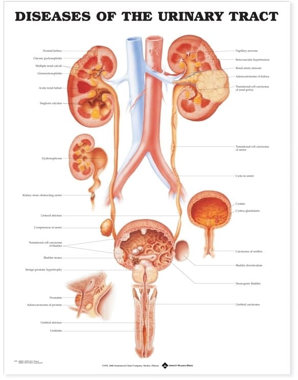 Diseases of the Urinary Tract Anatomical Chart