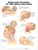 Whiplash Injuries of the Head and Neck Anatomical Chart