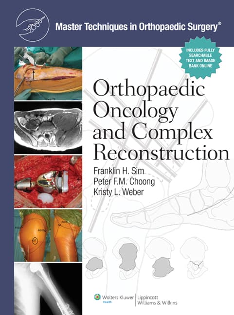 Master Techniques in Orthopaedic Surgery: Orthopaedic Oncology and Complex  Reconstruction