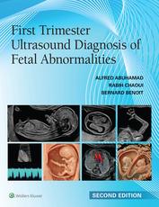 First Trimester Ultrasound Diagnosis of Fetal Abnormalities