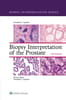 Biopsy Interpretation of the Prostate