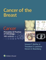 Cancer of the Breast