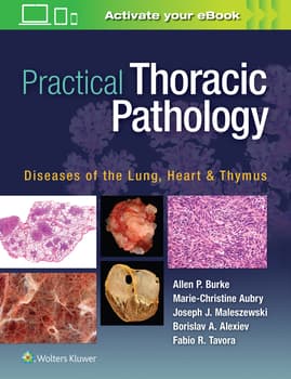 Practical Thoracic Pathology