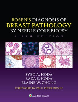 Rosen's Diagnosis of Breast Pathology by Needle Core Biopsy