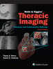 Webb & Higgins Thoracic Imaging: eBook with Multimedia