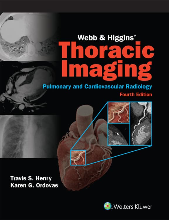 Webb & Higgins Thoracic Imaging: eBook with Multimedia