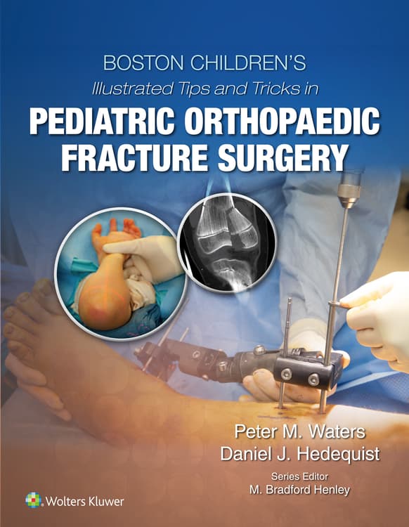Boston Children's Illustrated Tips and Tricks  in Pediatric Orthopaedic Fracture Surgery