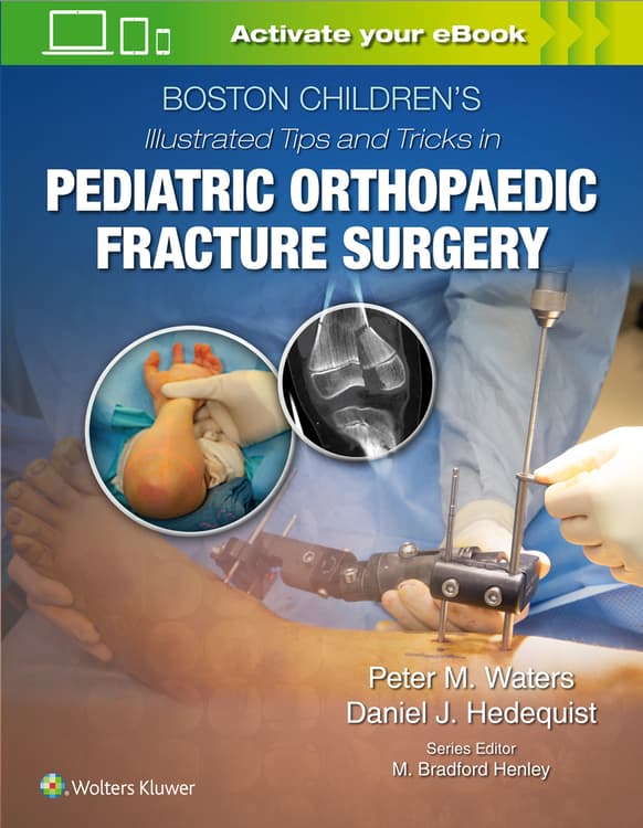 Boston Children’s Illustrated Tips and Tricks  in Pediatric Orthopaedic Fracture Surgery