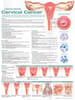 Understanding Cervical Cancer Anatomical Chart