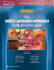 The Direct Anterior Approach to Hip Reconstruction