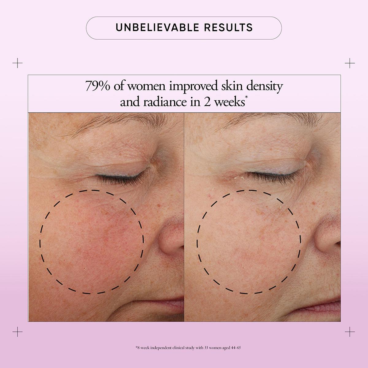 Philosophy Ultimate Miracle Worker SPF 30