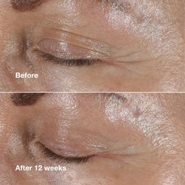 Clinique Smart Clinical Repair™ Wrinkle Correcting Eye Cream