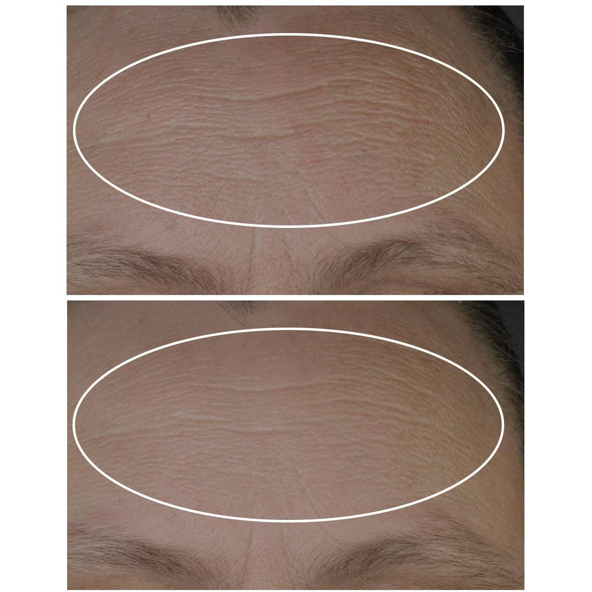 StriVectin Discovery Series Anti-Wrinkle Travel Trio