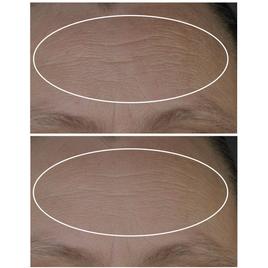 StriVectin Discovery Series Anti-Wrinkle Travel Trio