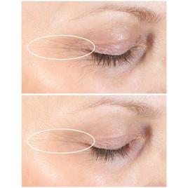 StriVectin Discovery Series Anti-Wrinkle Travel Trio