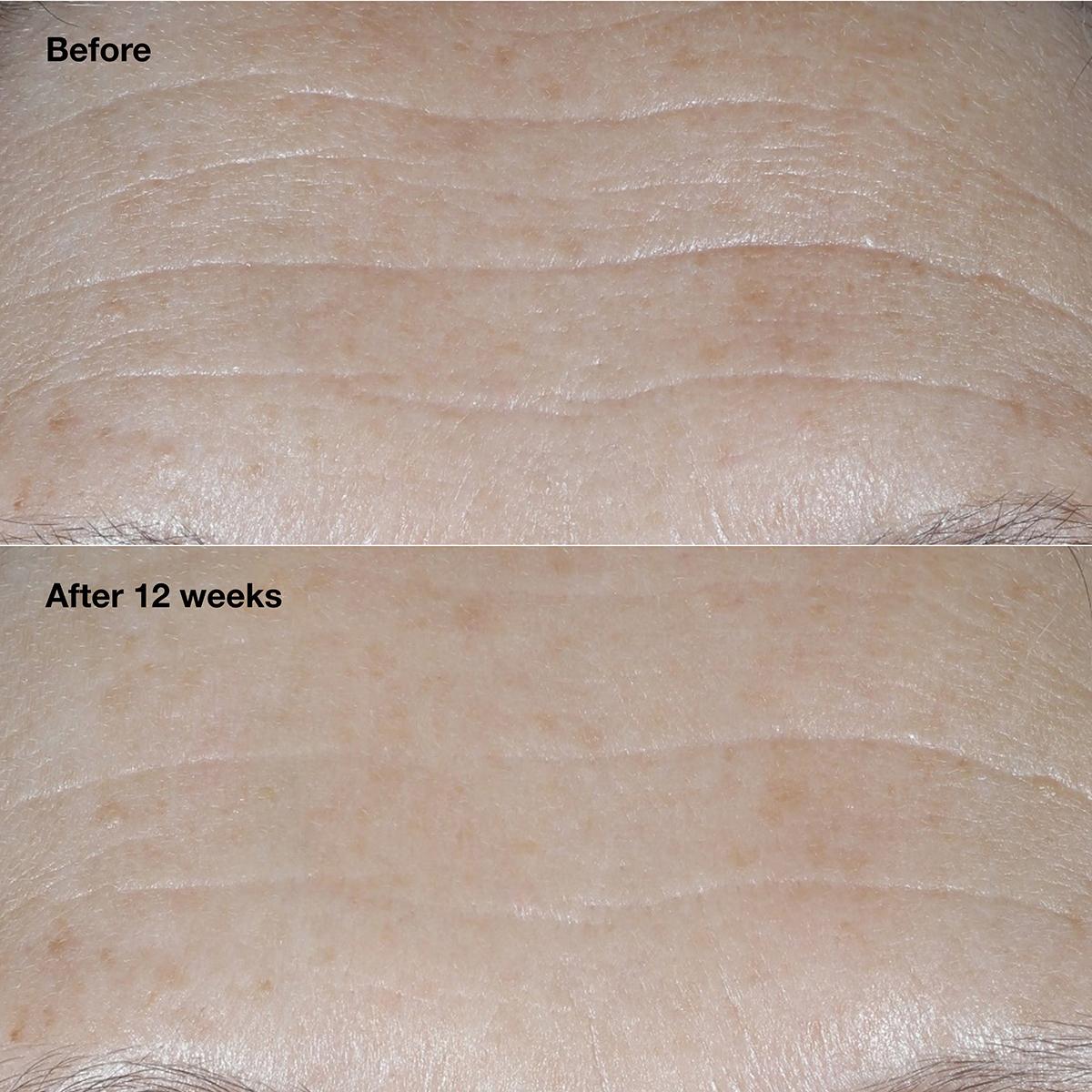 Clinique Smart Clinical Repair™ Broad Spectrum Wrinkle Cream