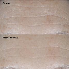 Clinique Smart Clinical Repair™ Broad Spectrum Wrinkle Cream