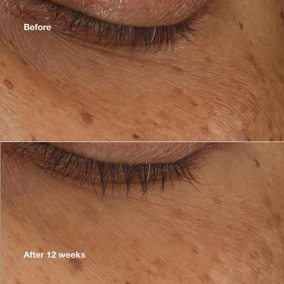 Clinique All About Eyes™ Brightening Serum with Retinoid