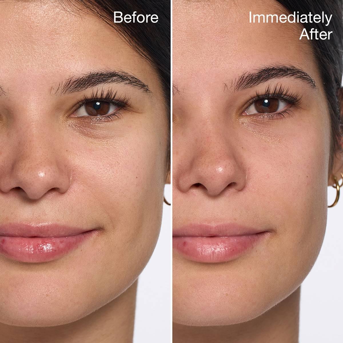 Clinique All About Eyes™ Eye Cream with Vitamin C