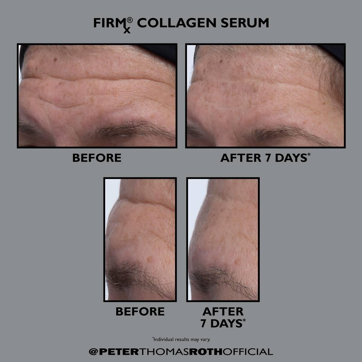Peter Thomas Roth FIRMx Collagen Serum